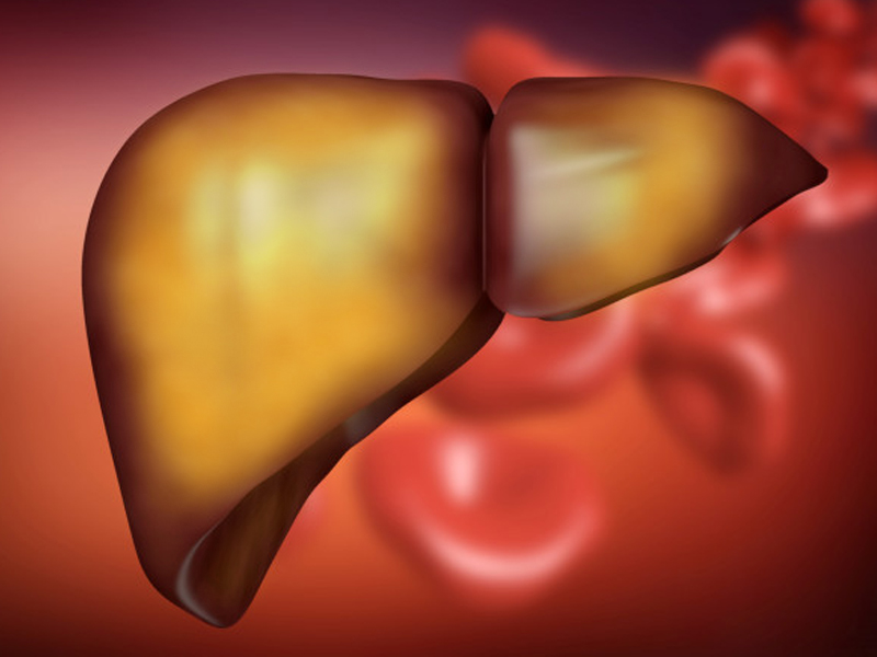 Liver Fat Accumulation