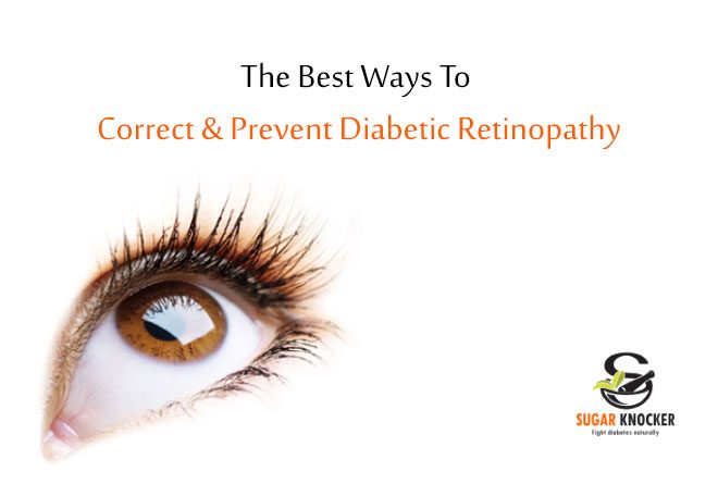 Best Ways To Correct & Prevent Diabetic Retinopathy