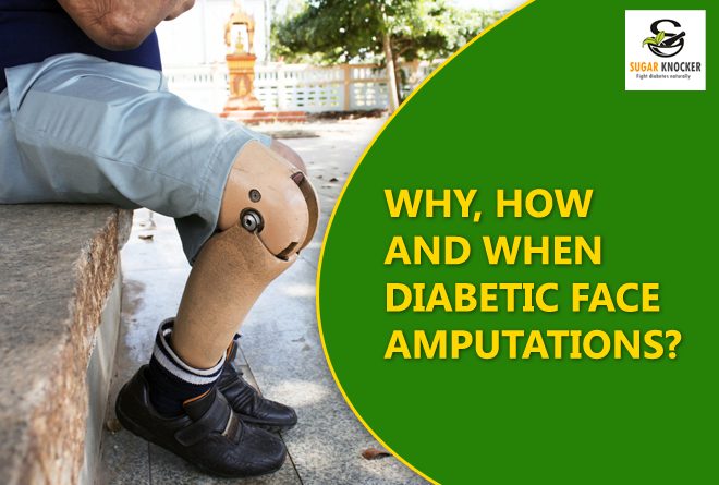Why, How and When Diabetic Face Amputations?