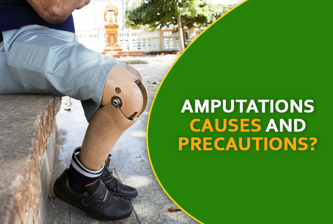 What is Amputation – Causes and Precautions!!