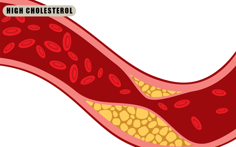 Berberine Benefits Diabetes - Reduces High Cholesterol