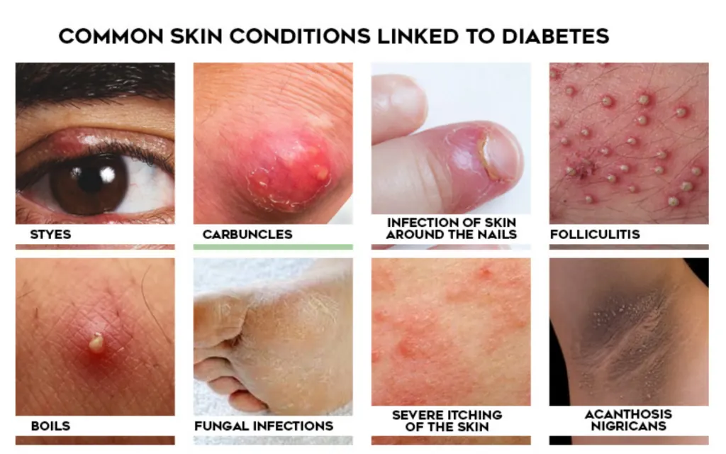 diabetes skin problem