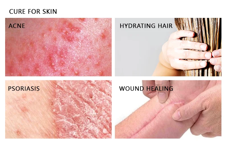 skin benefits of kalonji