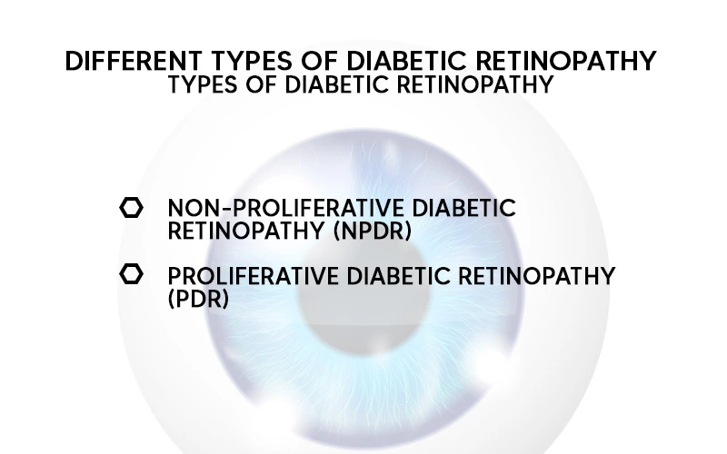 types of diabetic retinopathy