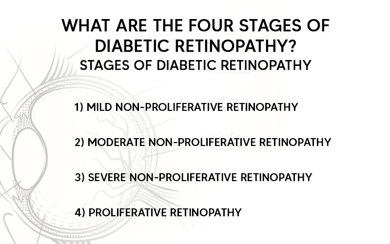 stages of diabetic retinopathy