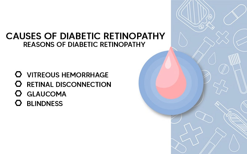 causes of diabetic retinopathy