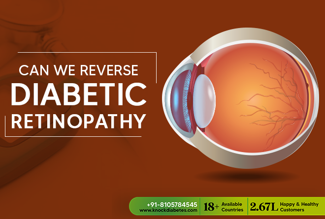 Can Diabetic Retinopathy be Reversed with Diet?