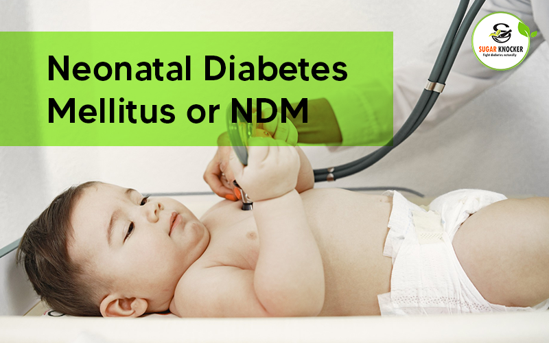 Neonatal Diabetes Mellitus or NDM