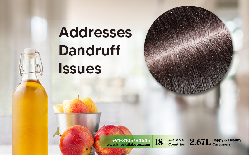 Addresses Dandruff Issues