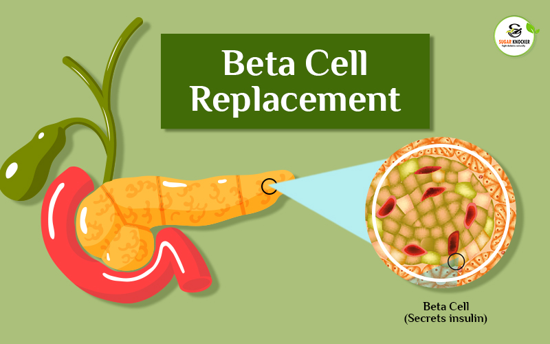 Beta Cell Replacement