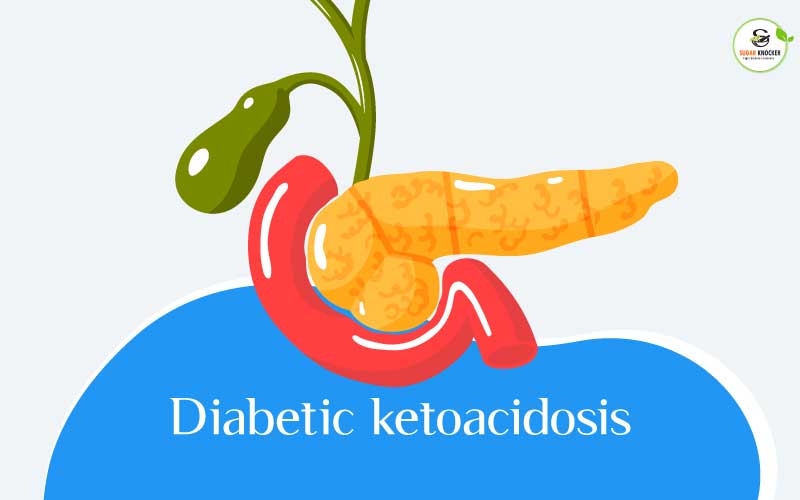 Diabetic ketoacidosis