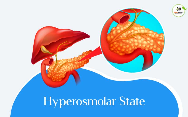 Hyperglycemia Hyperosmolar State 