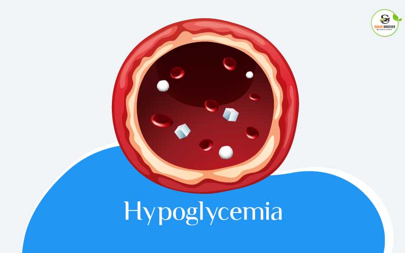 Hypoglycemia