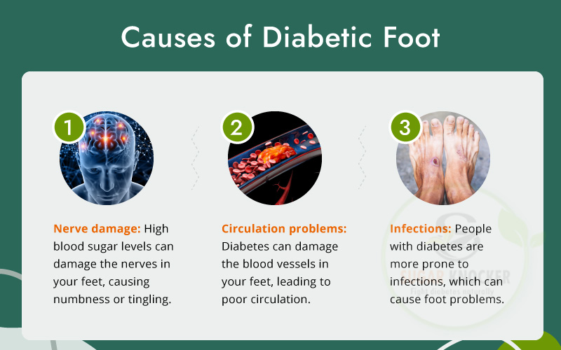 Causes Diabetes-Related Foot Conditions?
